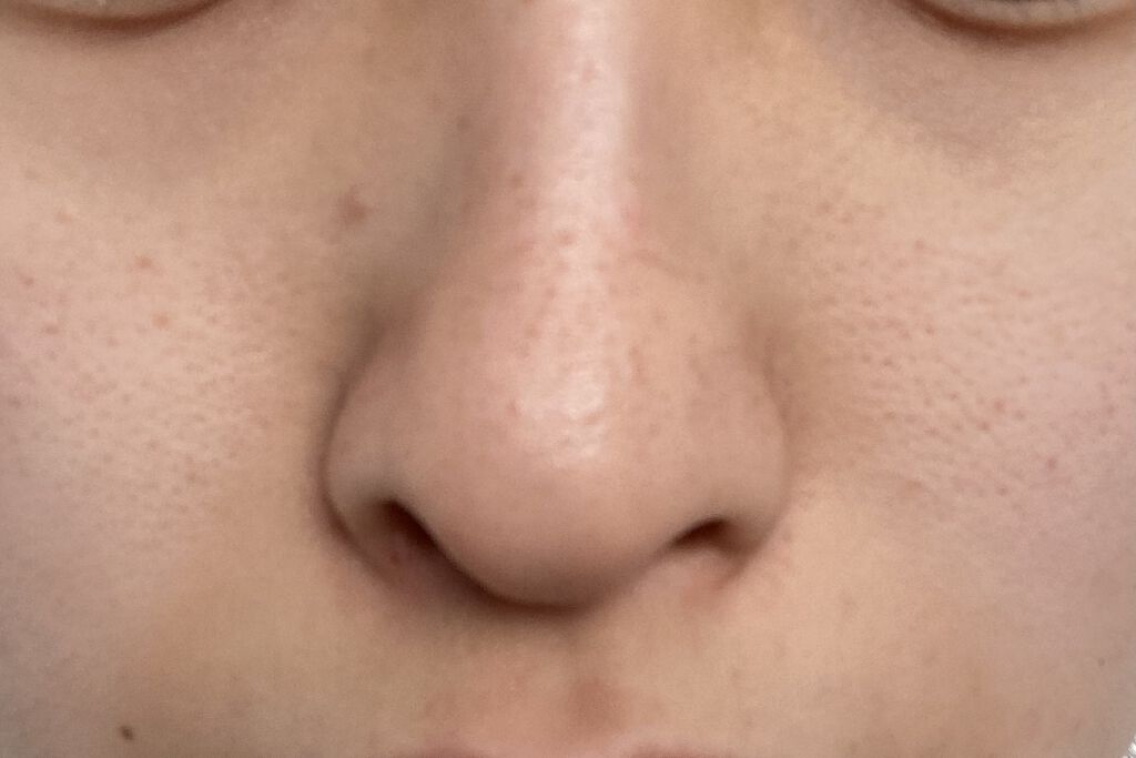 お米のマスク/毛穴撫子/シートマスク・パックを使ったクチコミ（1枚目）