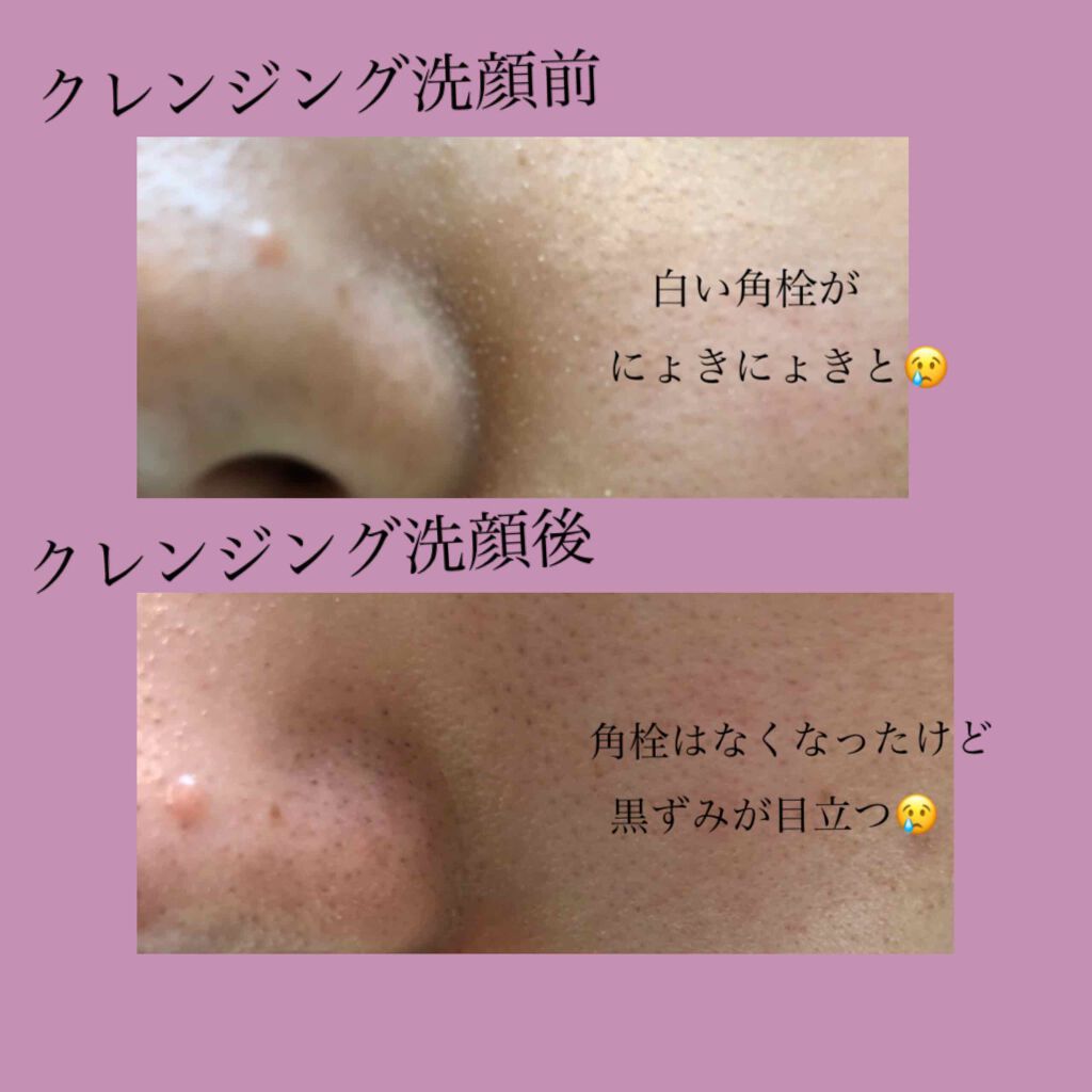 ニベアソフト スキンケアクリーム/ニベア/ボディクリームを使ったクチコミ(2枚目)