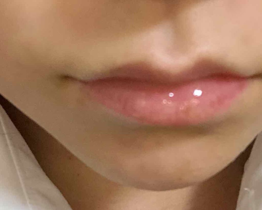 リップフォンデュ/メンソレータム/リップバームを使ったクチコミ（2枚目）