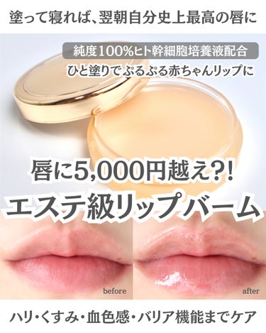 EVER MOIST LIP BALM/XOUL/リップケア・リップクリームを使ったクチコミ（1枚目）