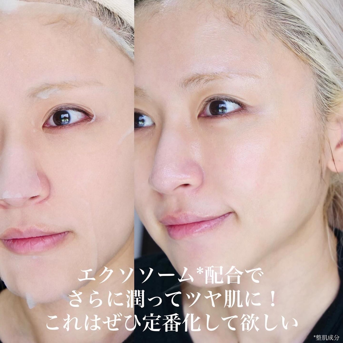 ダーマレーザー スーパーVC100+エクソソーム マスク/クオリティファースト/シートマスク・パックを使ったクチコミ(5枚目)