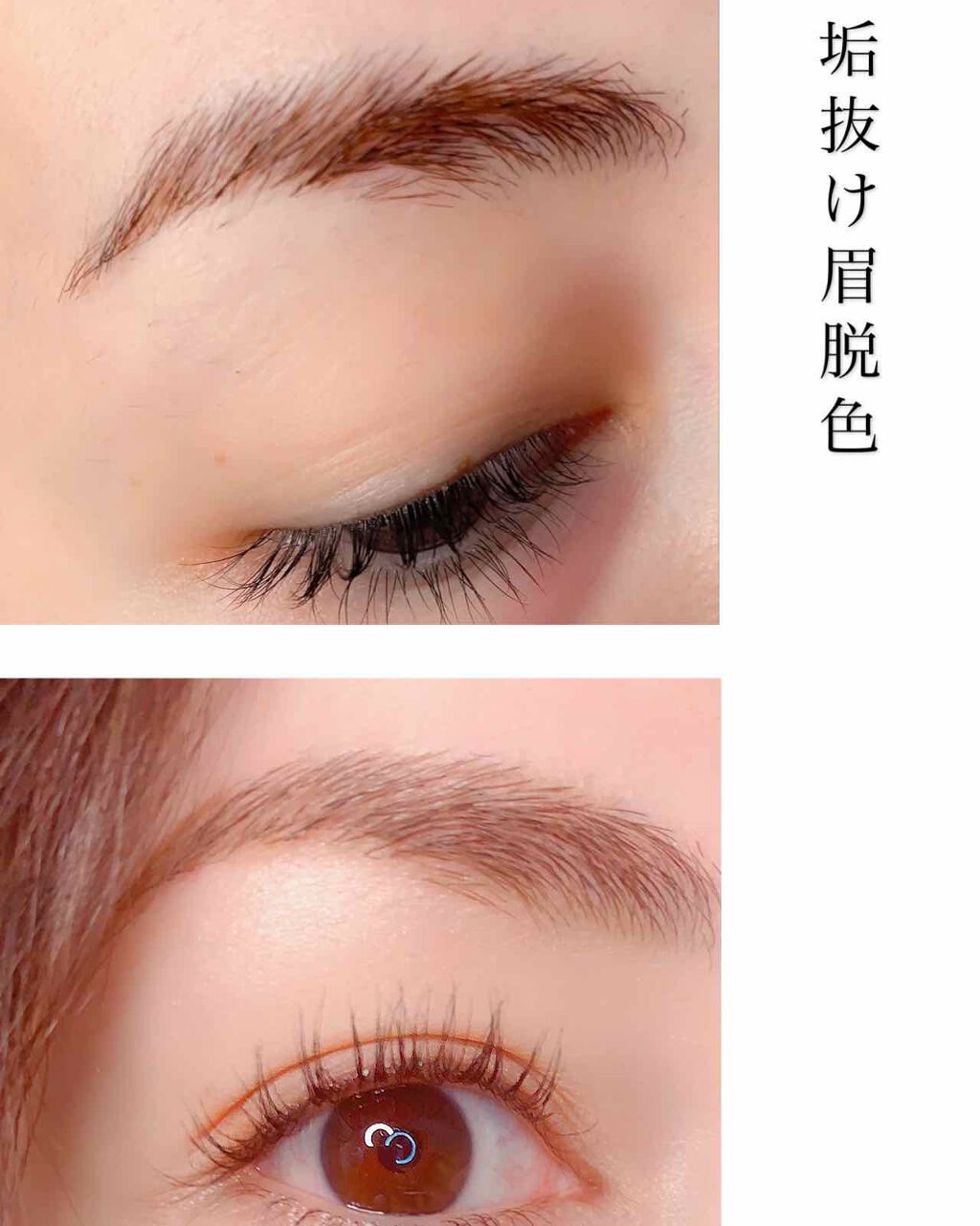 脱色クリーム スピーディー/エピラット/ムダ毛ケアを使ったクチコミ（1枚目）