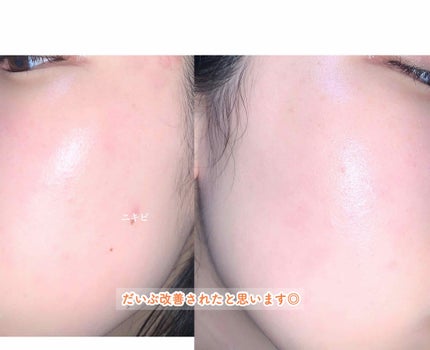 グリーンタンジェリン ビタC ダークスポットケアセラム/goodal/美容液を使ったクチコミ(3枚目)