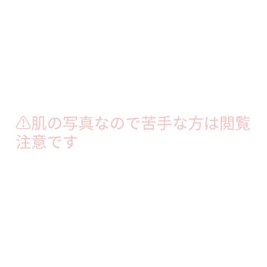 薬用3ステップセット30日サイズ/プロアクティブ/トライアルキットを使ったクチコミ（2枚目）