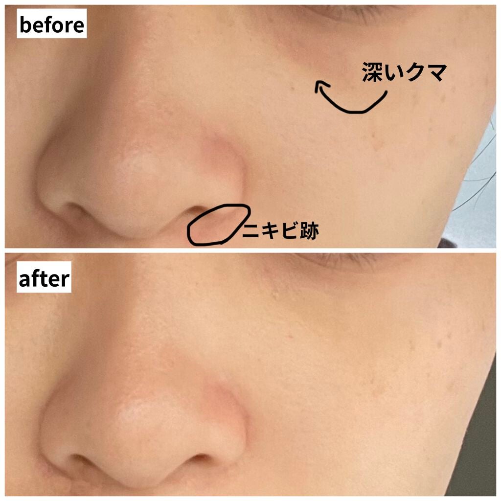 アウト オブ サイト コンシーラー/MARY QUANT/リキッドコンシーラーを使ったクチコミ(3枚目)