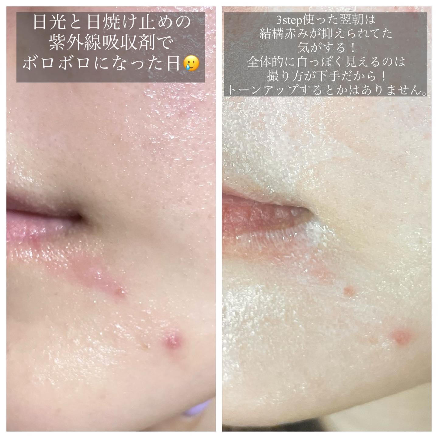 ソルトクリーム/ABpharm/フェイスクリームを使ったクチコミ（2枚目）