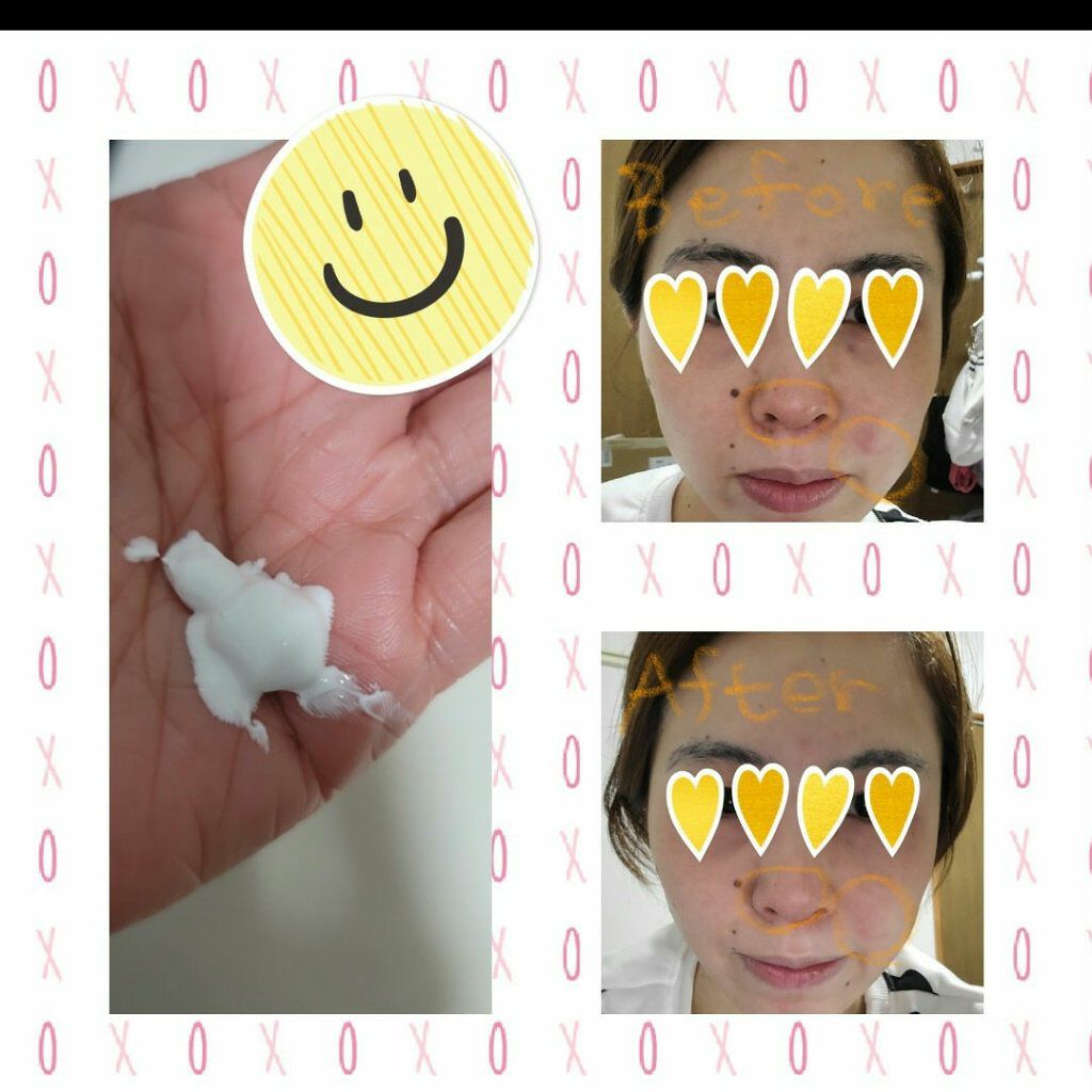 デュイセル ターンオンクリーム/DEWYCEL/フェイスクリームを使ったクチコミ(1枚目)