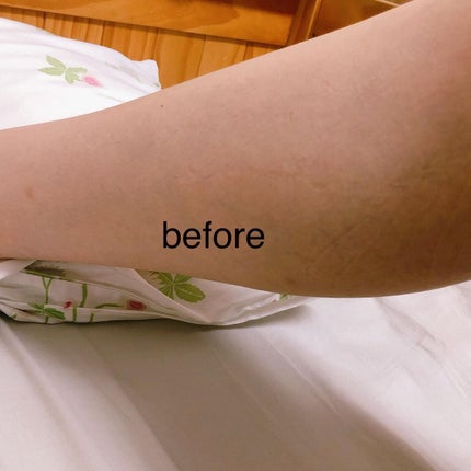 ニードルボディスクラブ/NNE/ボディスクラブを使ったクチコミ(4枚目)