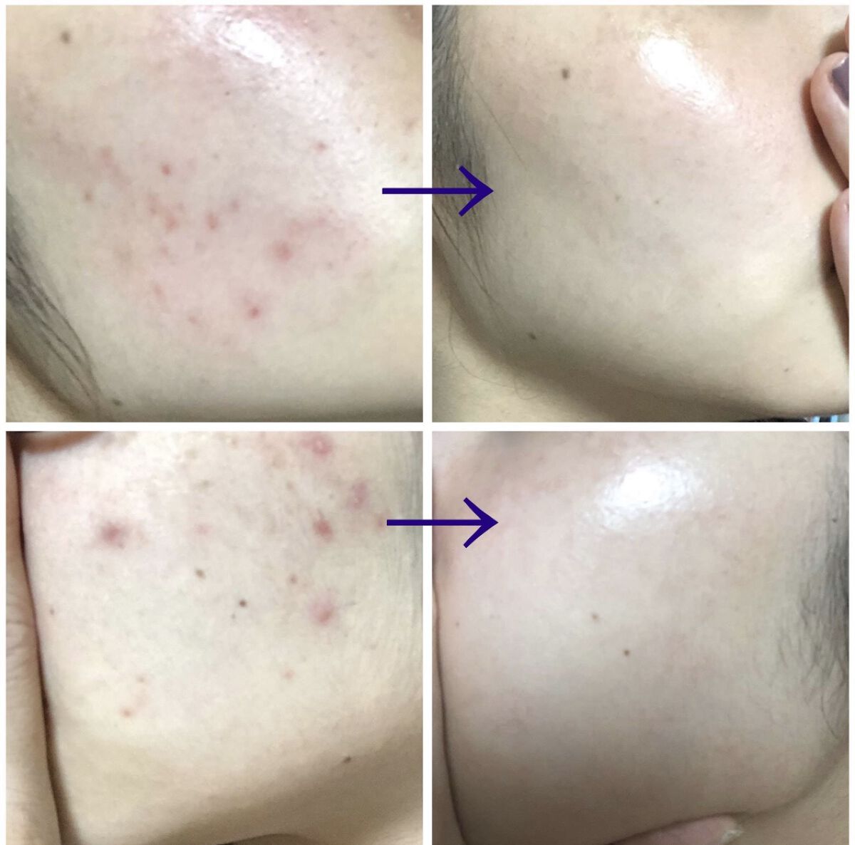 化粧水・敏感肌用・高保湿タイプ/無印良品/化粧水を使ったクチコミ（1枚目）