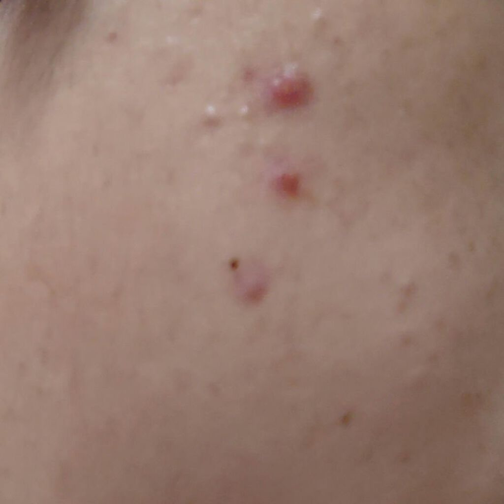 毎日、まなざシートアイマスク EXスムース/EVERYYOU/アイケア・アイクリームを使ったクチコミ（2枚目）