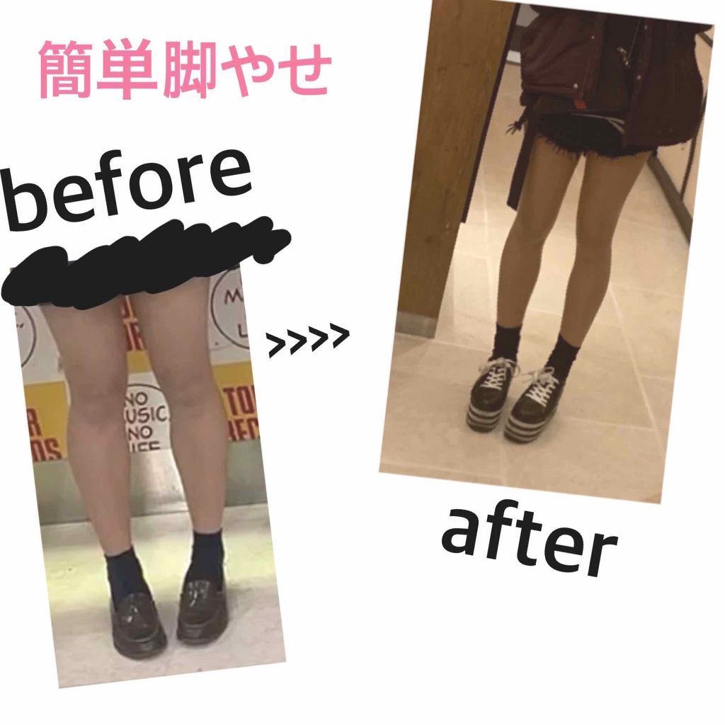 ボディシェイプ 寝ながらスパッツ 骨盤サポート付き/メディキュット/着圧ソックス・レギンスを使ったクチコミ（1枚目）