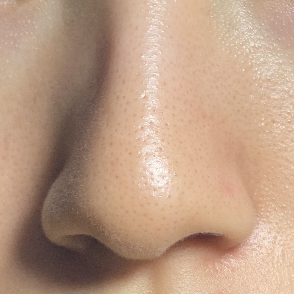 薬用しみ集中対策 プレミアム美容液/メラノCC/美容液を使ったクチコミ（3枚目）