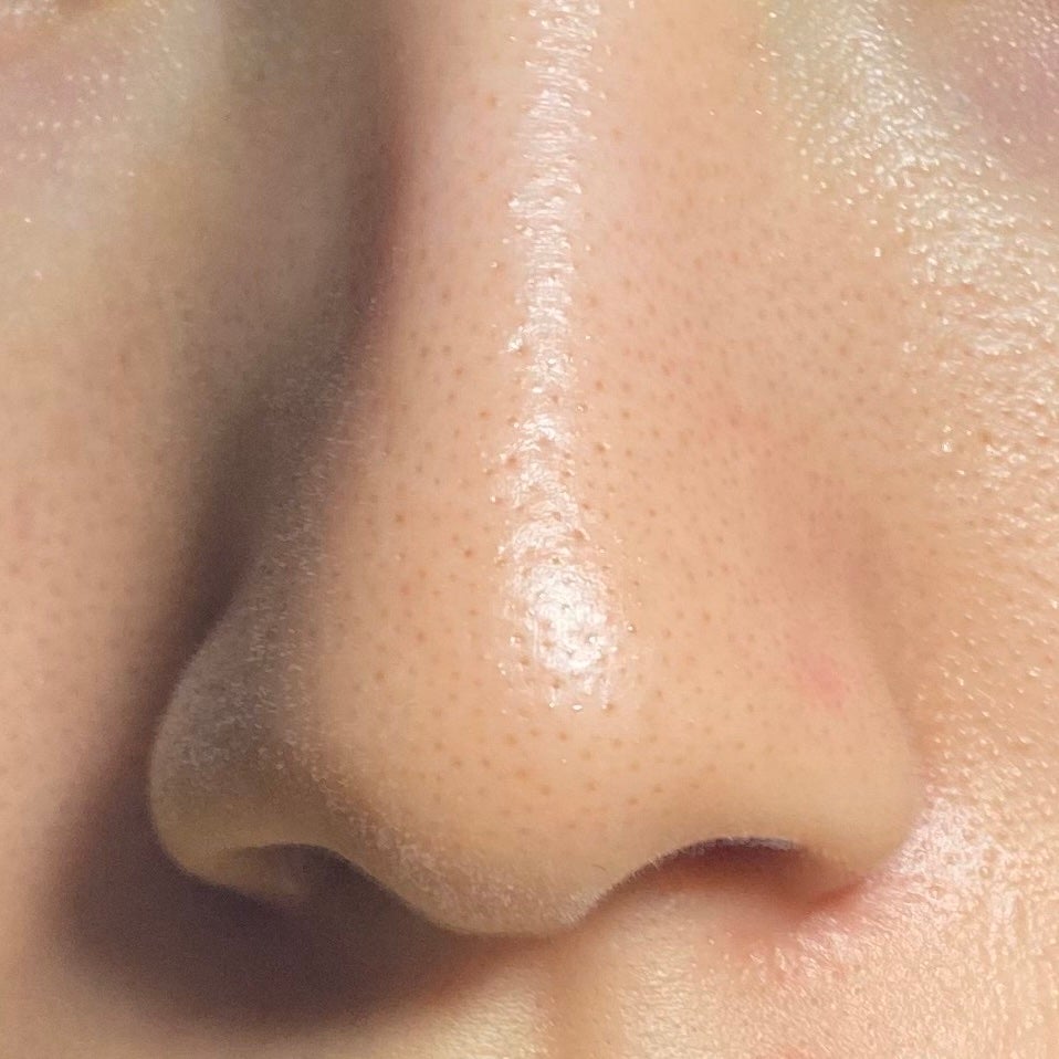 薬用しみ集中対策 プレミアム美容液/メラノCC/美容液を使ったクチコミ(3枚目)