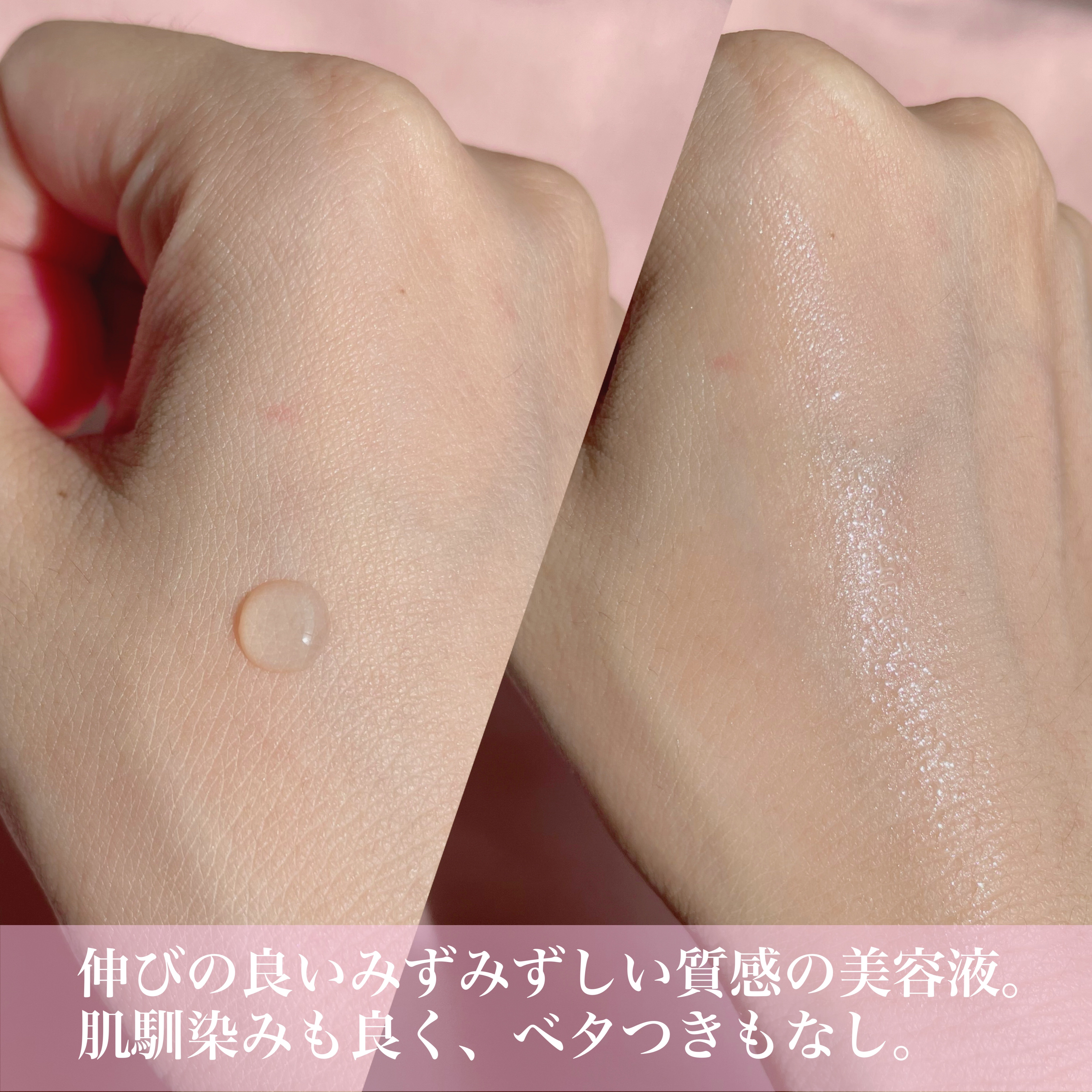 ダーマレーザー ウルセラC/クオリティファースト/美容液を使ったクチコミ（3枚目）