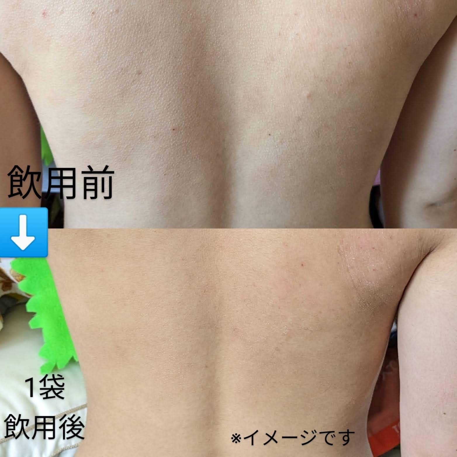 Hadaral 十味敗毒湯錠(医薬品)/大峰堂/その他を使ったクチコミ（1枚目）