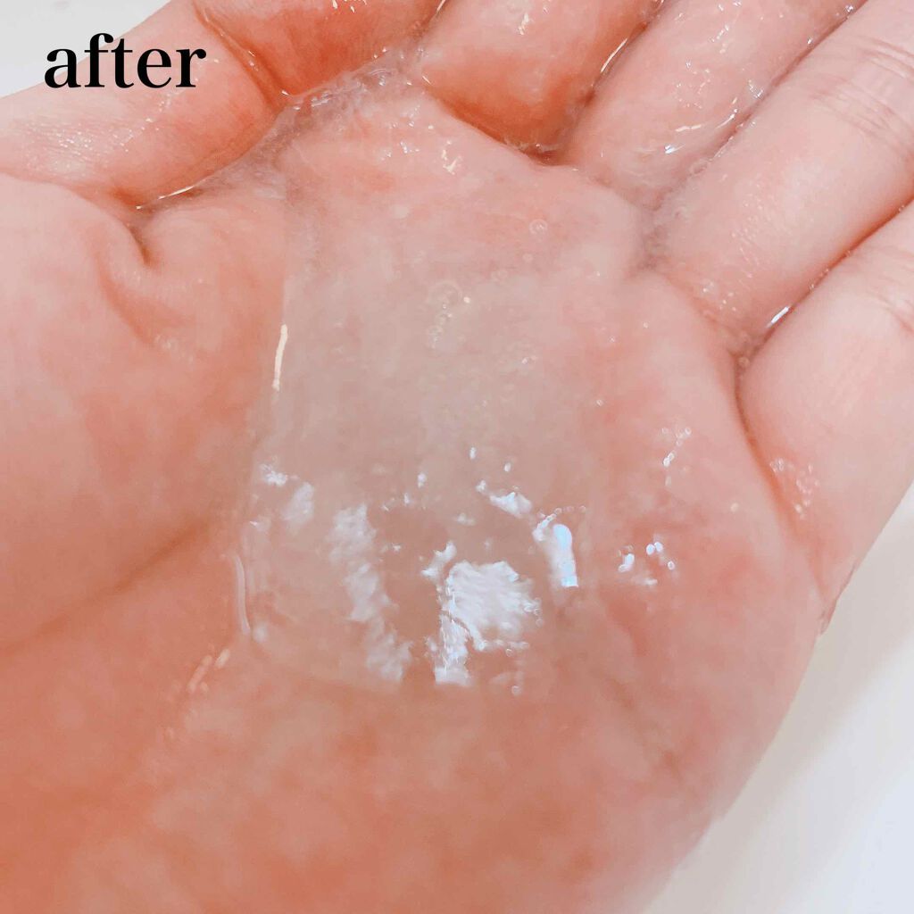 温感ヘッドスパトリートメント/TRICORE/頭皮トリートメントを使ったクチコミ(3枚目)