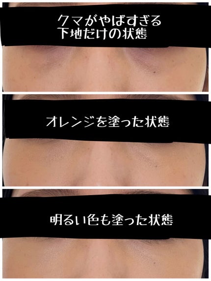 フーミー キニシーラー/WHOMEE/パレットコンシーラーを使ったクチコミ(4枚目)