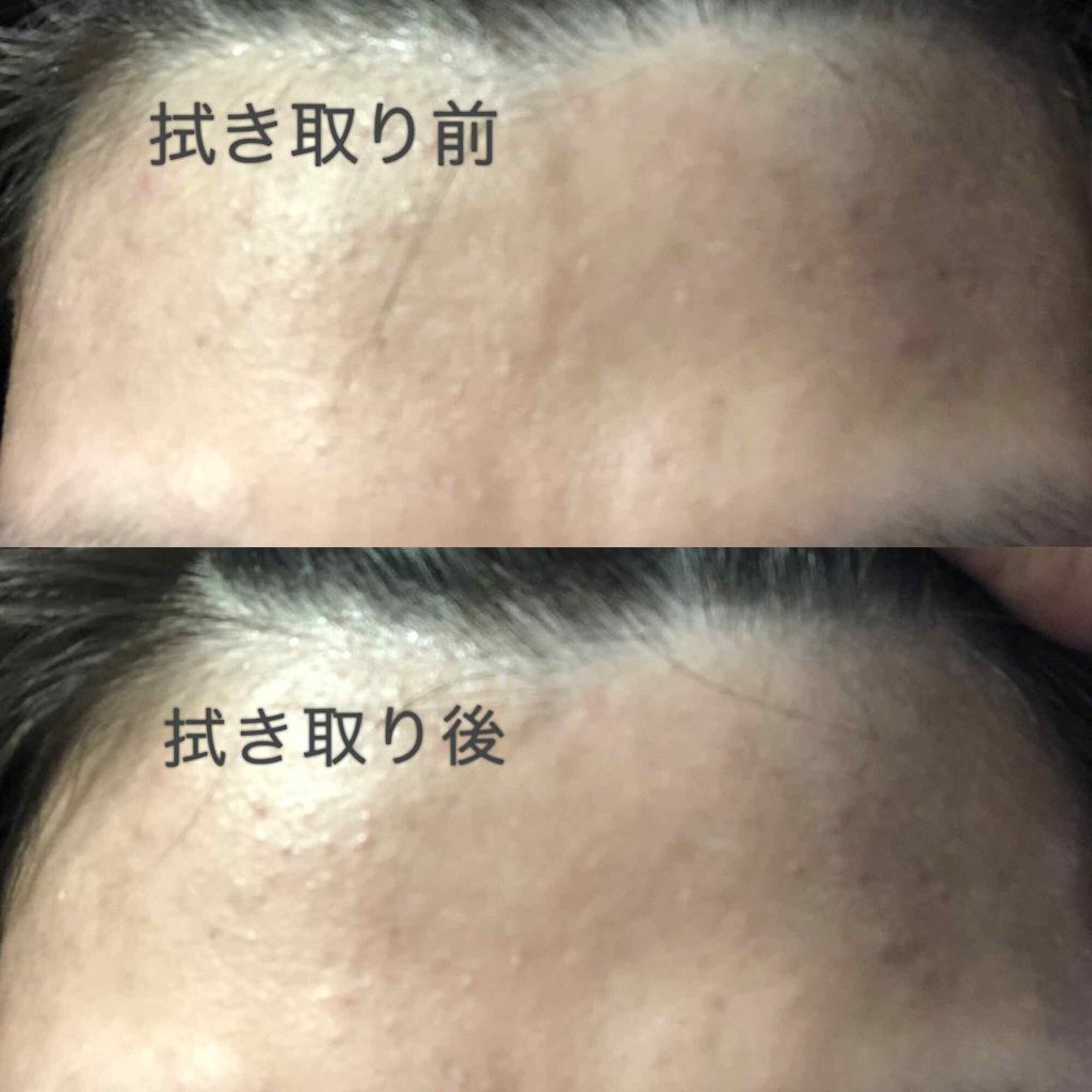 明色美顔水 薬用化粧水/美顔/化粧水を使ったクチコミ（2枚目）