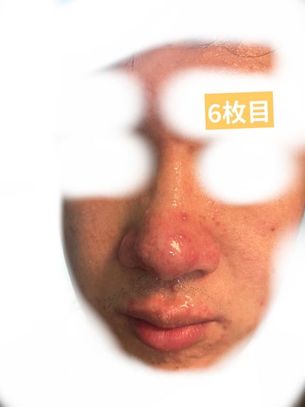 デイリーケアマスク ヒアルロン酸&グレープフルーツ/RISM/シートマスク・パックを使ったクチコミ(6枚目)