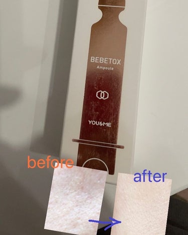 BEBETOX Ampoule/YOU&ME/美容液を使ったクチコミ（6枚目）