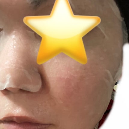 ティーツリーケア ソリューション エッセンシャルマスクEX/MEDIHEAL/シートマスク・パックを使ったクチコミ(4枚目)