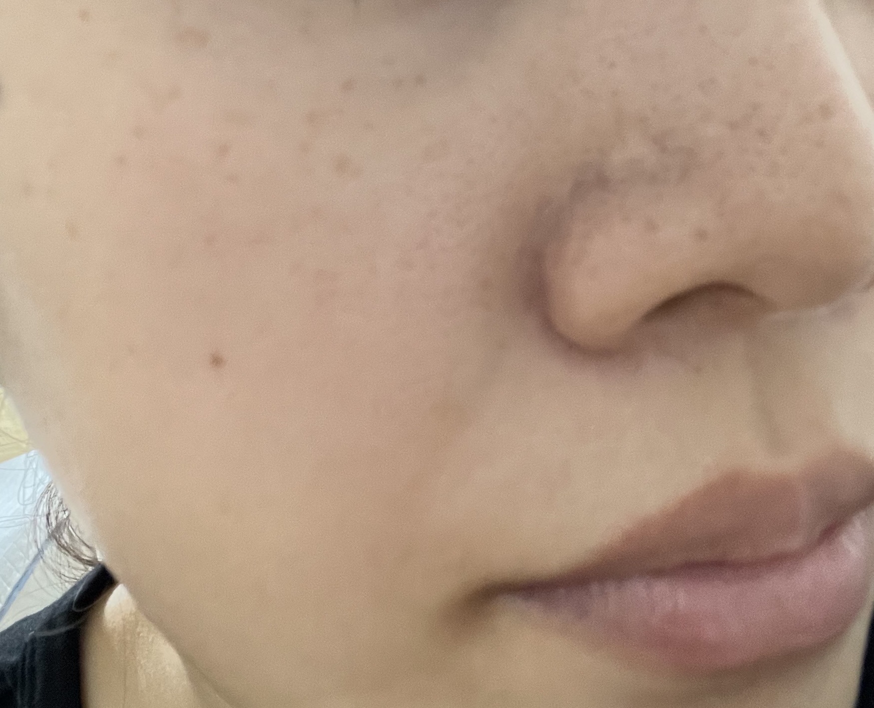 アイレノールすっぴんクリーム/IRENOL/クリームコンシーラーを使ったクチコミ（3枚目）