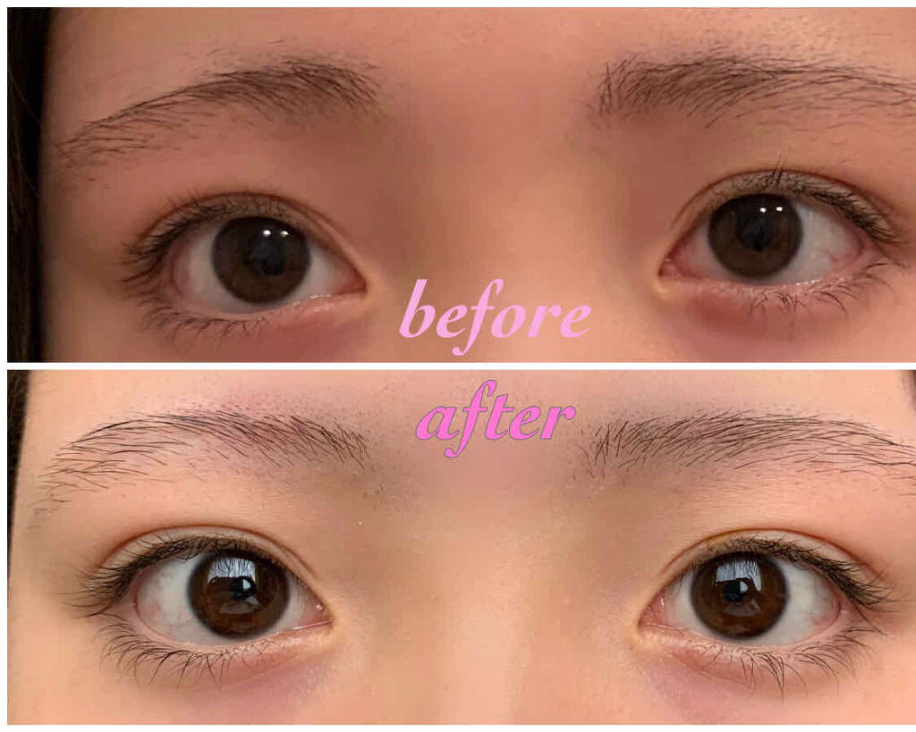 ローヤルゼリー配合 栄養ローション/DAISO/美容液を使ったクチコミ（2枚目）