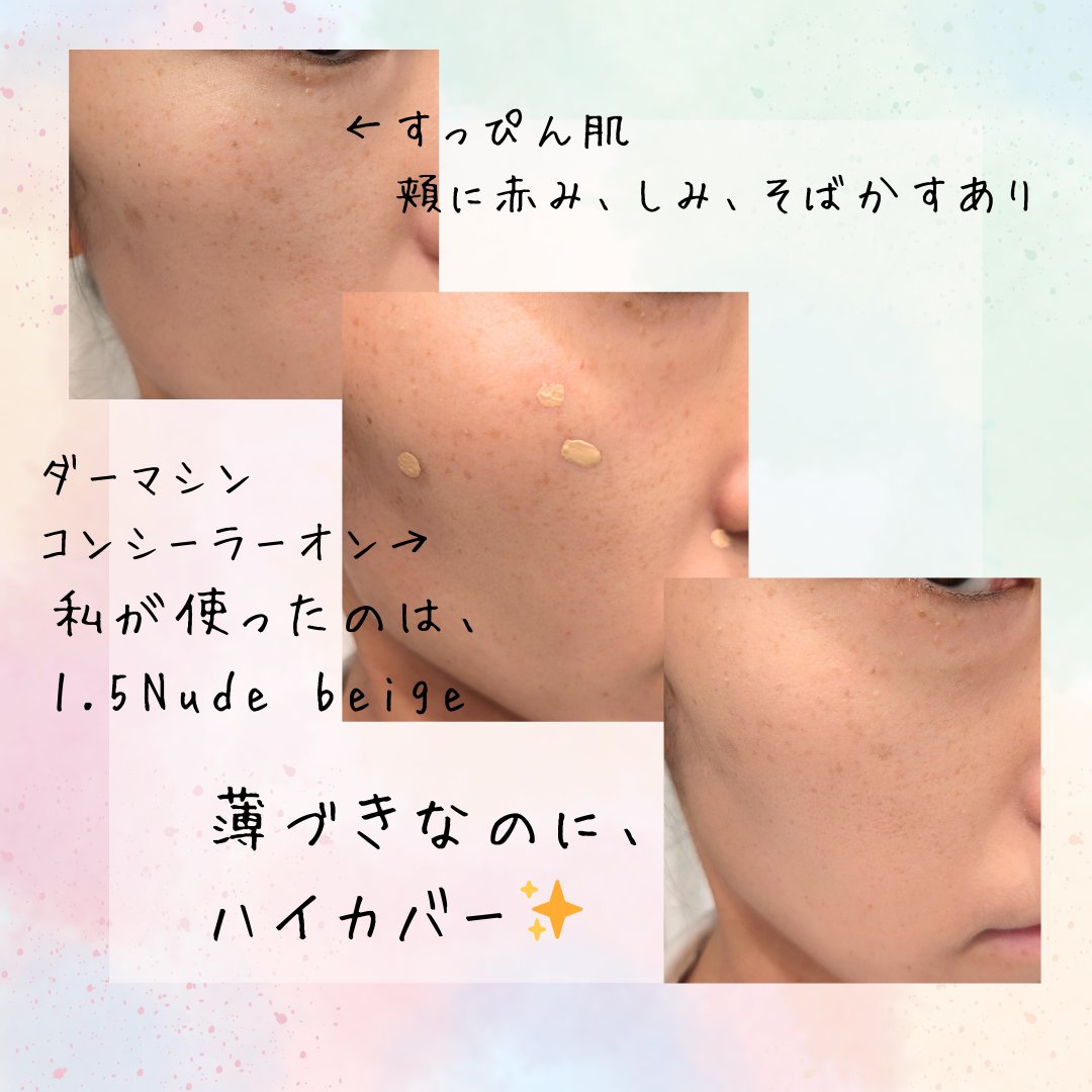 ダーマシンコンシーラー/23years old/リキッドコンシーラーを使ったクチコミ（2枚目）