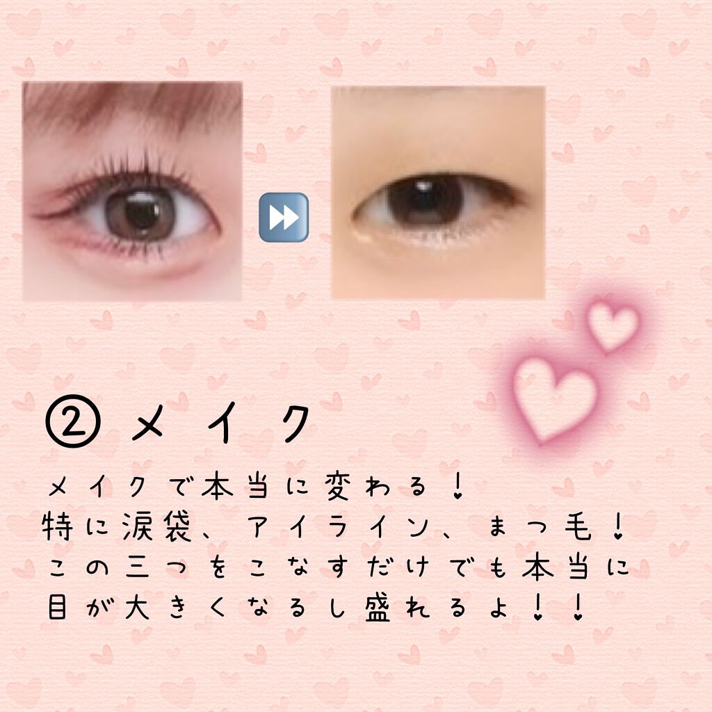 のびーるアイテープ(絆創膏タイプ、レギュラー)/DAISO/二重まぶた用アイテムを使ったクチコミ(3枚目)