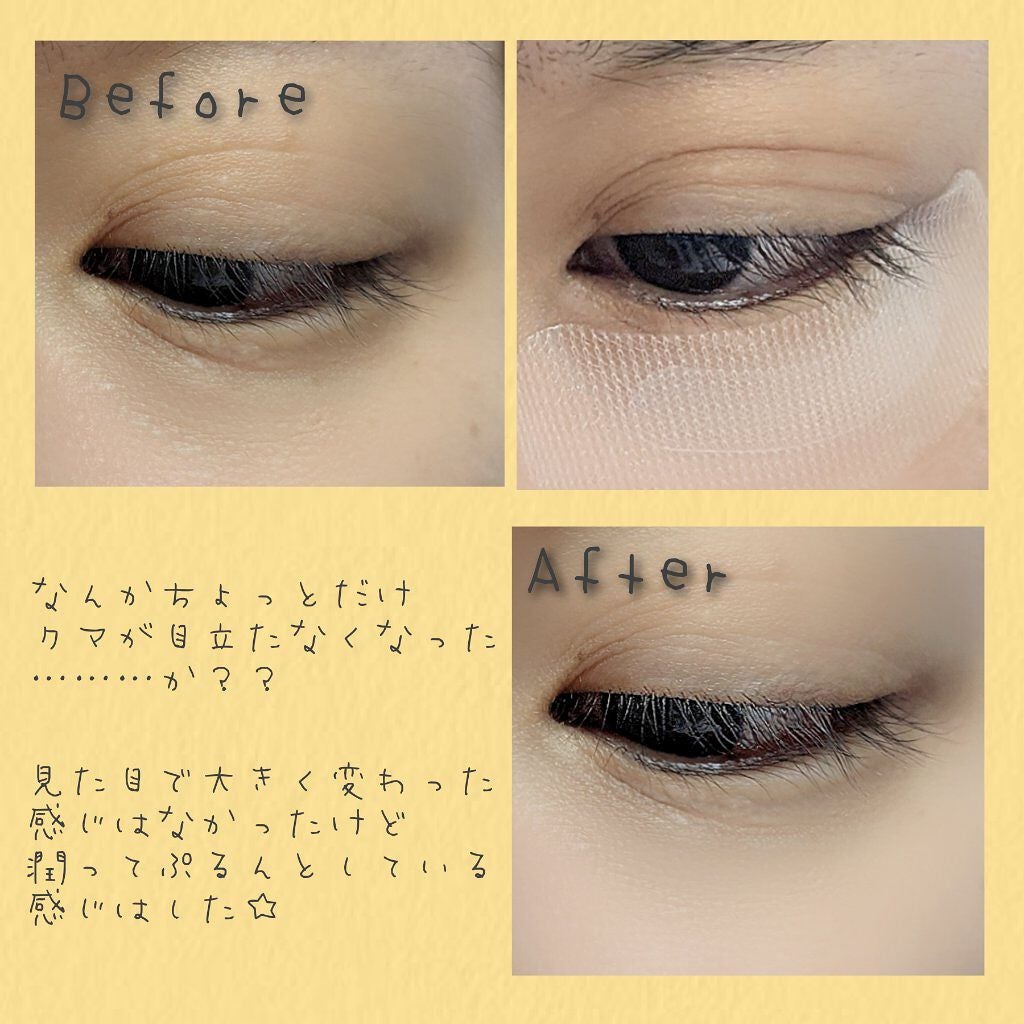 クリアターン ヒアロチューン マイクロパッチ 1500/クリアターン/シートマスク・パックを使ったクチコミ(2枚目)