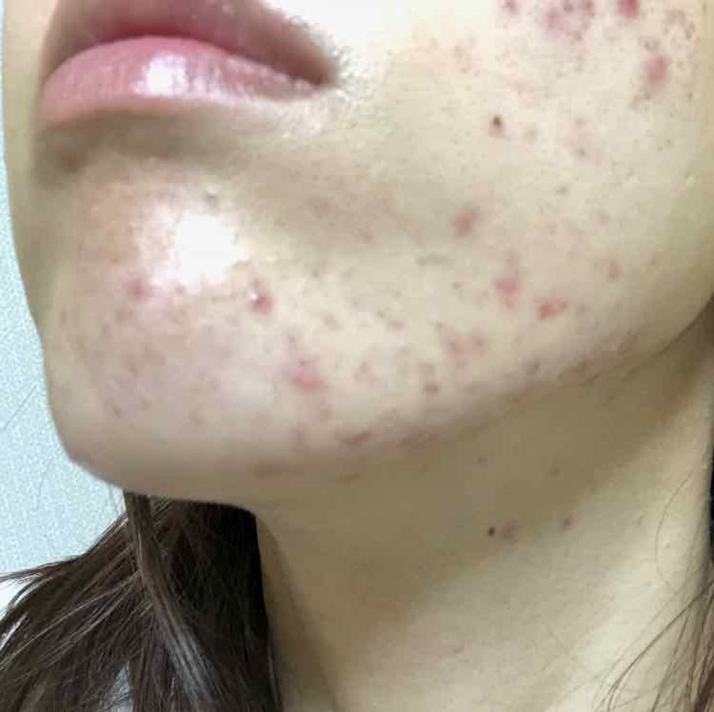 DHC はとむぎエキス/DHC/健康サプリメントを使ったクチコミ(3枚目)