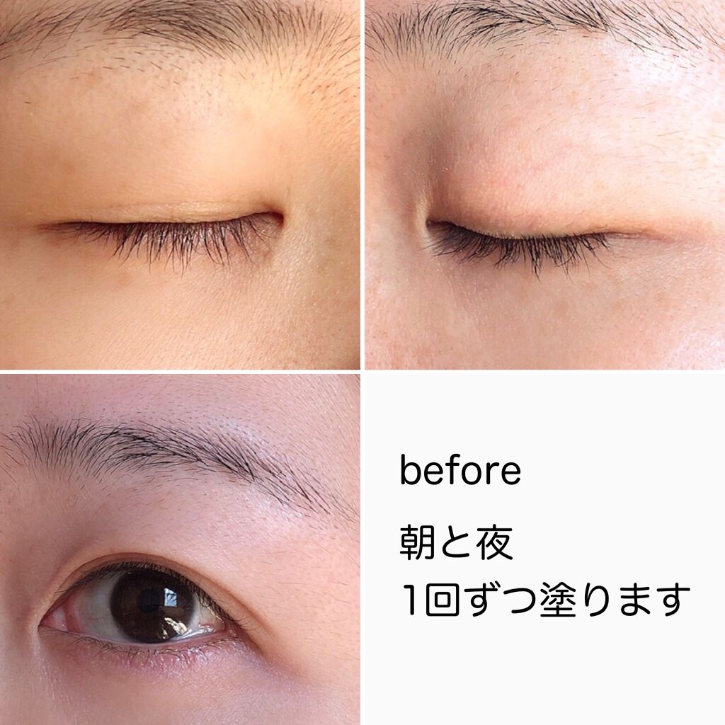 グロウアイラッシュセラム/フェース/まつげ美容液を使ったクチコミ（3枚目）