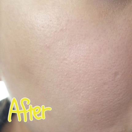 Skin Base Foundation/Illamasqua/リキッドファンデーションを使ったクチコミ(3枚目)