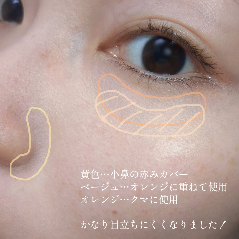 カラーミキシングコンシーラー 04 レッドベージュ/キャンメイク/パレットコンシーラーを使ったクチコミ（2枚目）