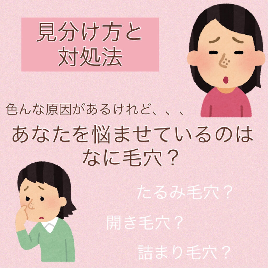 タカミスキンピール/タカミ/ブースター・導入液を使ったクチコミ（1枚目）