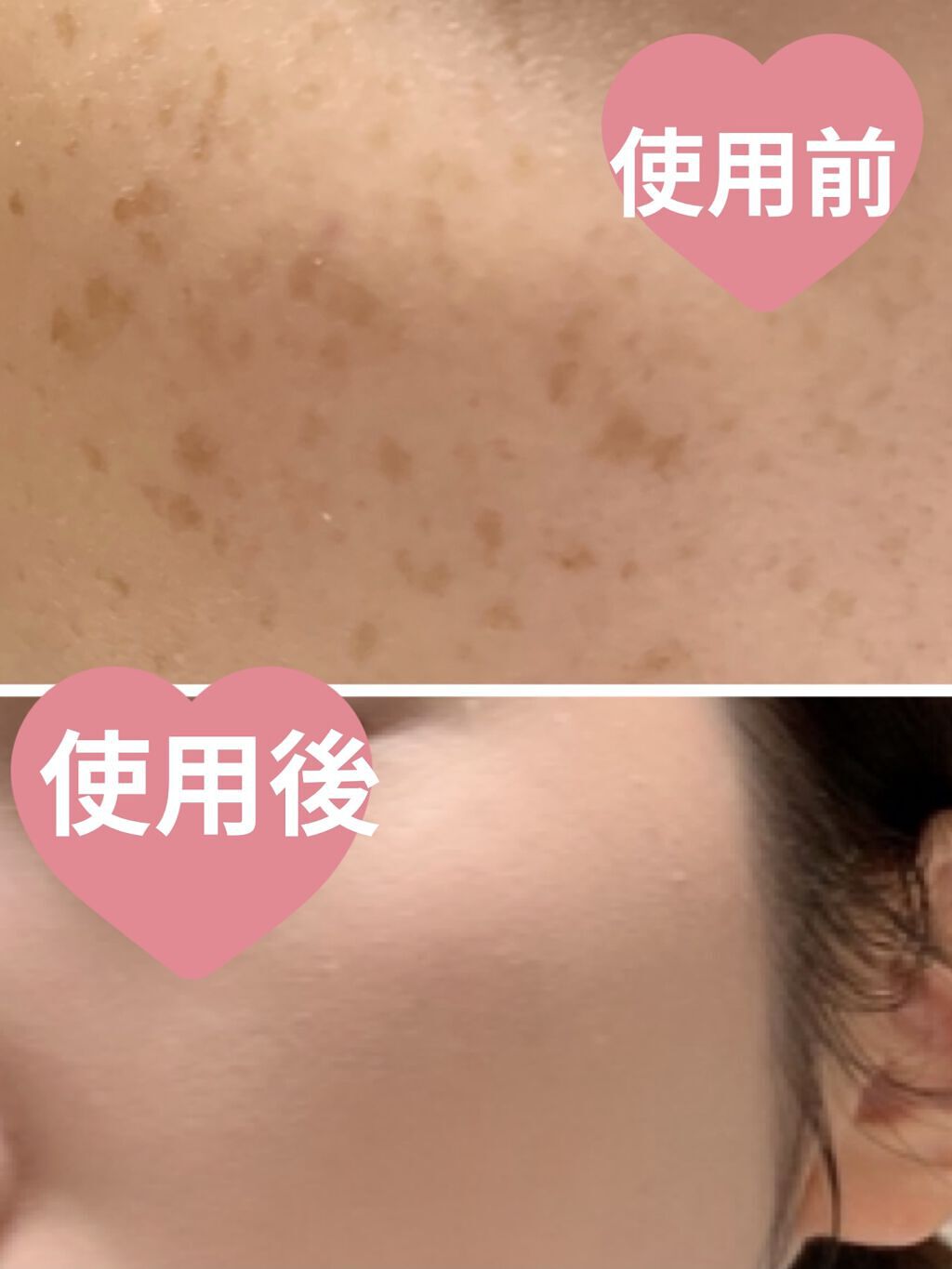 ninal コンシーラーセラム/ninal/リキッドコンシーラーを使ったクチコミ（3枚目）