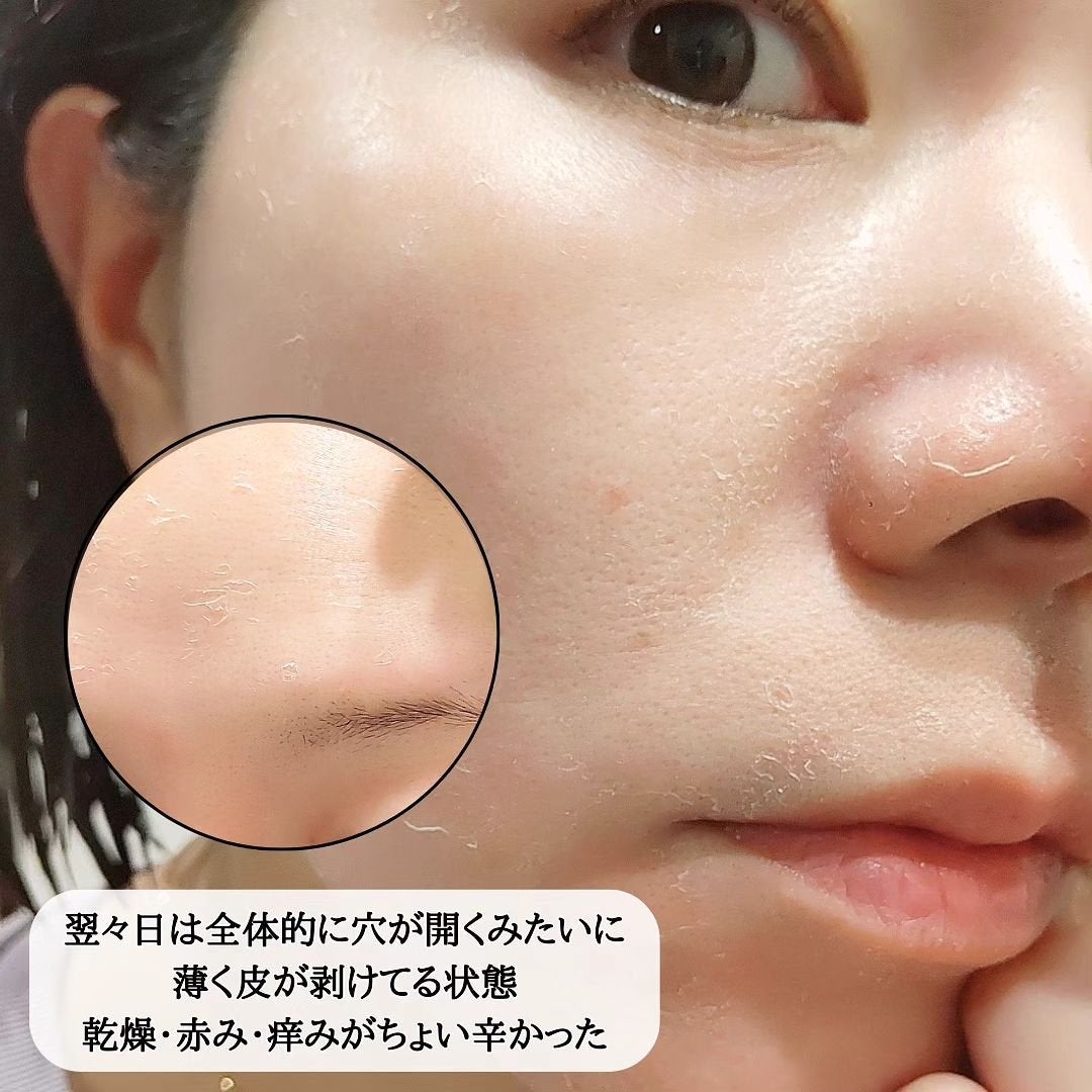 ダーマスキンピーリング/BQCELL/その他キットセットを使ったクチコミ(5枚目)