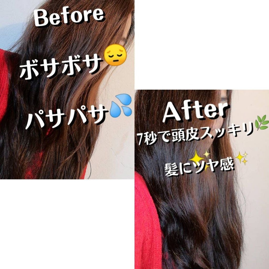 ヘッドスパセブン トリートメント/ヘッドスパセブン/頭皮トリートメントを使ったクチコミ(5枚目)