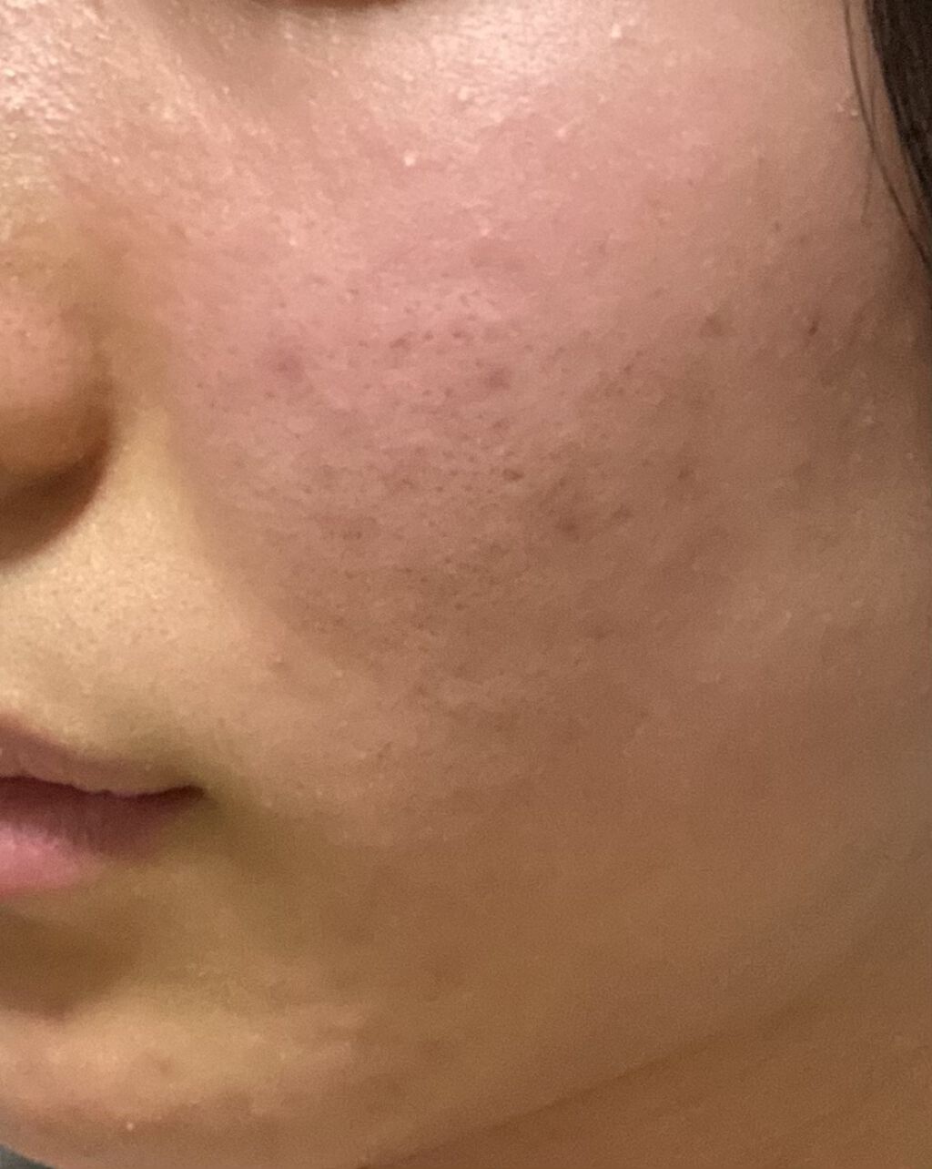 ティーツリーケア クレンジングフォーム JEX/MEDIHEAL/洗顔フォームを使ったクチコミ（2枚目）