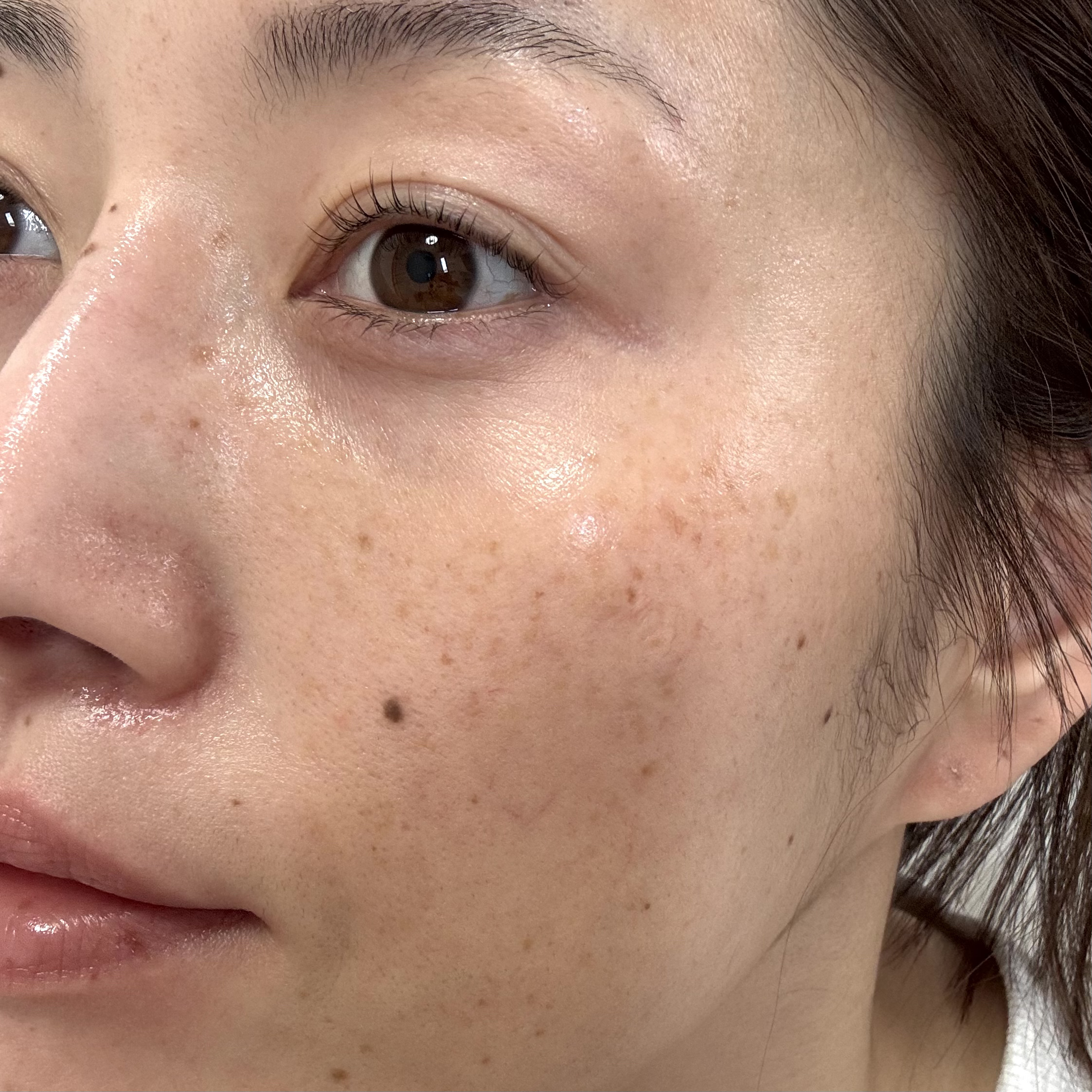 VC100エッセンスローション EX/ドクターシーラボⓇ/化粧水を使ったクチコミ（3枚目）