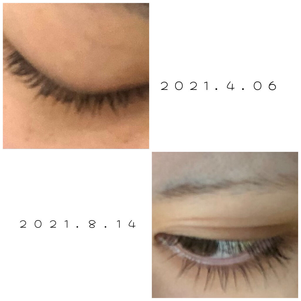 アヴァンセ ラッシュセラム EX(医薬部外品)/アヴァンセ/その他を使ったクチコミ（2枚目）