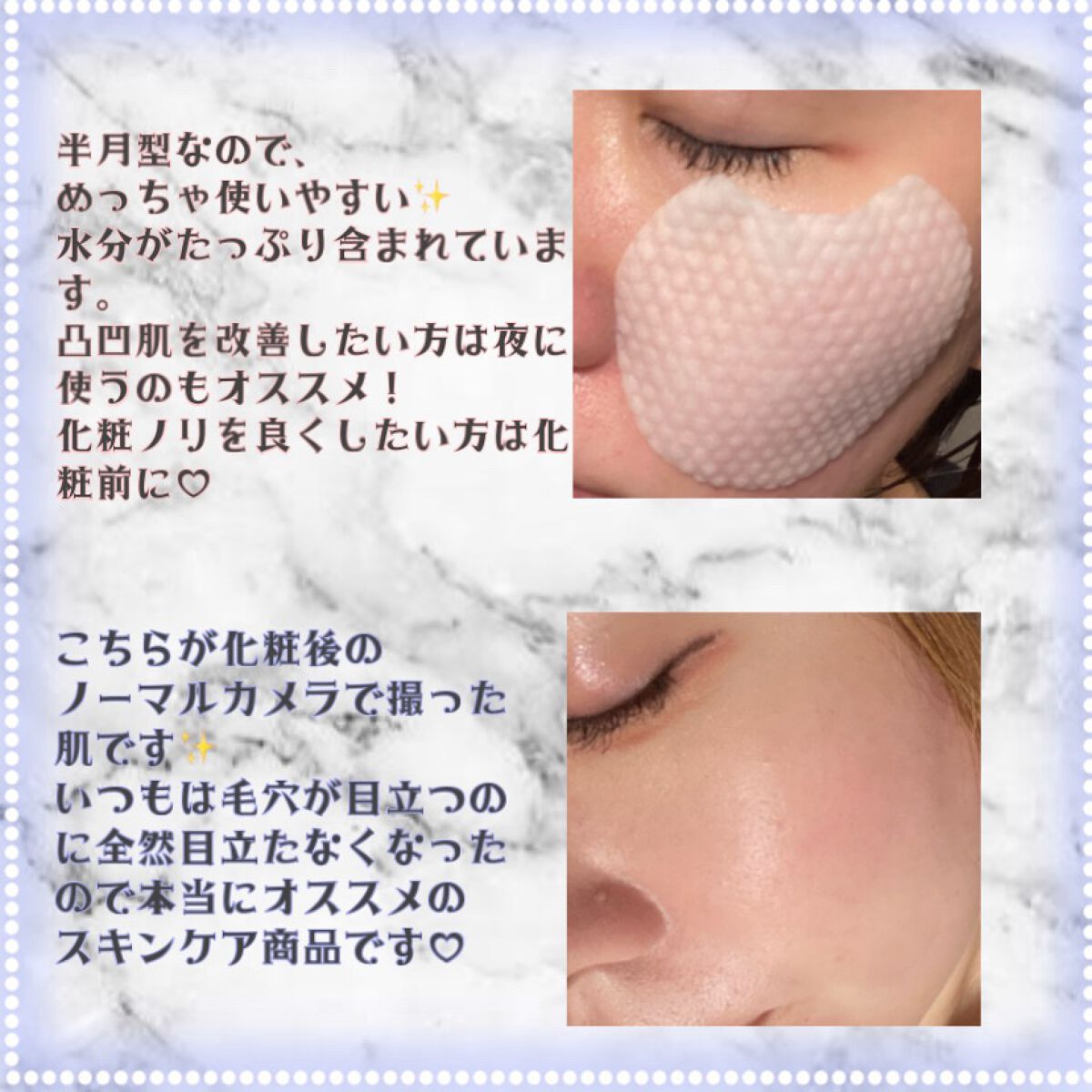 キメケア カバノアナタケバイオーム毛穴パッド/efilow/トナーパッドを使ったクチコミ（3枚目）