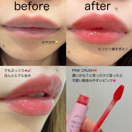 ジューシーリッププラスプランパー/keybo/リッププランパーを使ったクチコミ(2枚目)