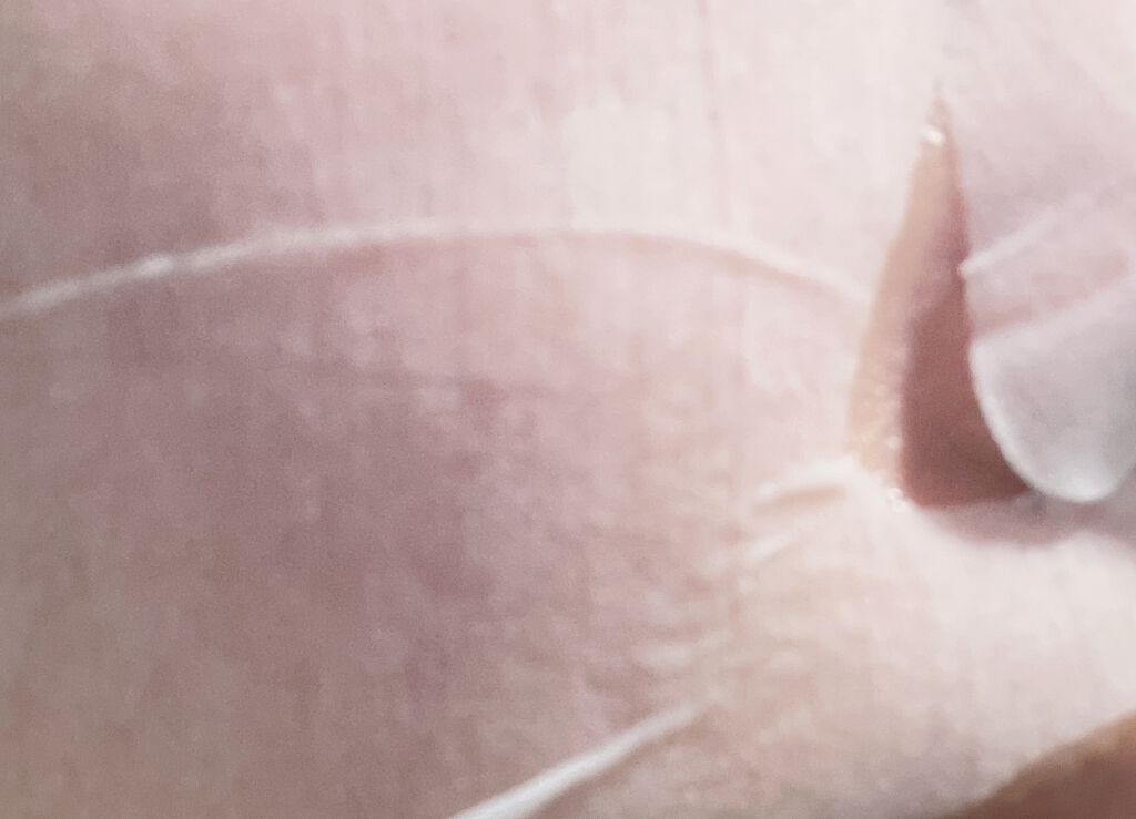 CHOI薬用マスク ニキビケア ［医薬部外品］/肌美精/シートマスク・パックを使ったクチコミ（3枚目）