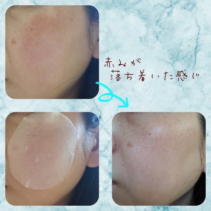 カロテンIPMP(TM) ブレミッシュカーミングセラムパッド/APRILSKIN/トナーパッドを使ったクチコミ(4枚目)