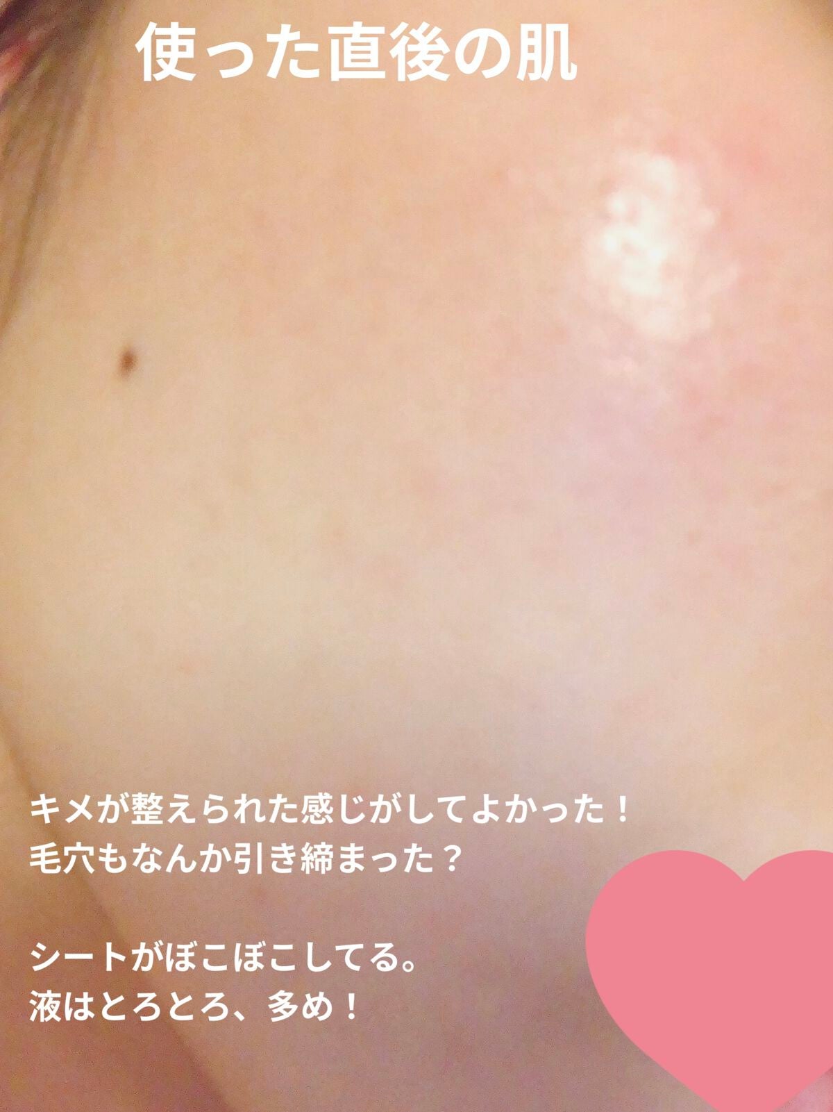 ごめんね素肌マスク/クリアターン/シートマスク・パックを使ったクチコミ(2枚目)