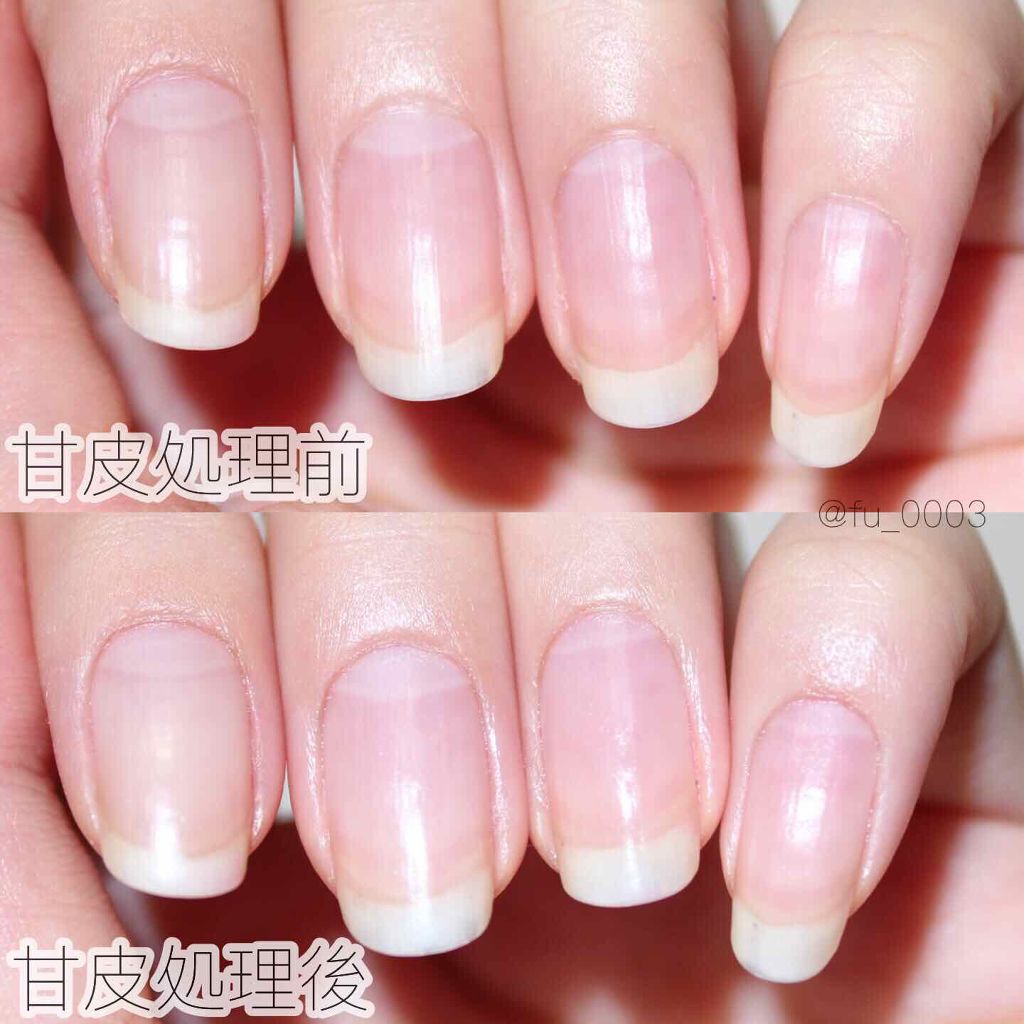 キューティクルリムーバーⅡ/デュカート/ネイルオイル・トリートメント by ふうか