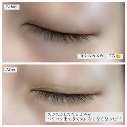 スカルプD アイラッシュセラム プレミアム/アンファー(スカルプD)/まつげ美容液を使ったクチコミ(5枚目)