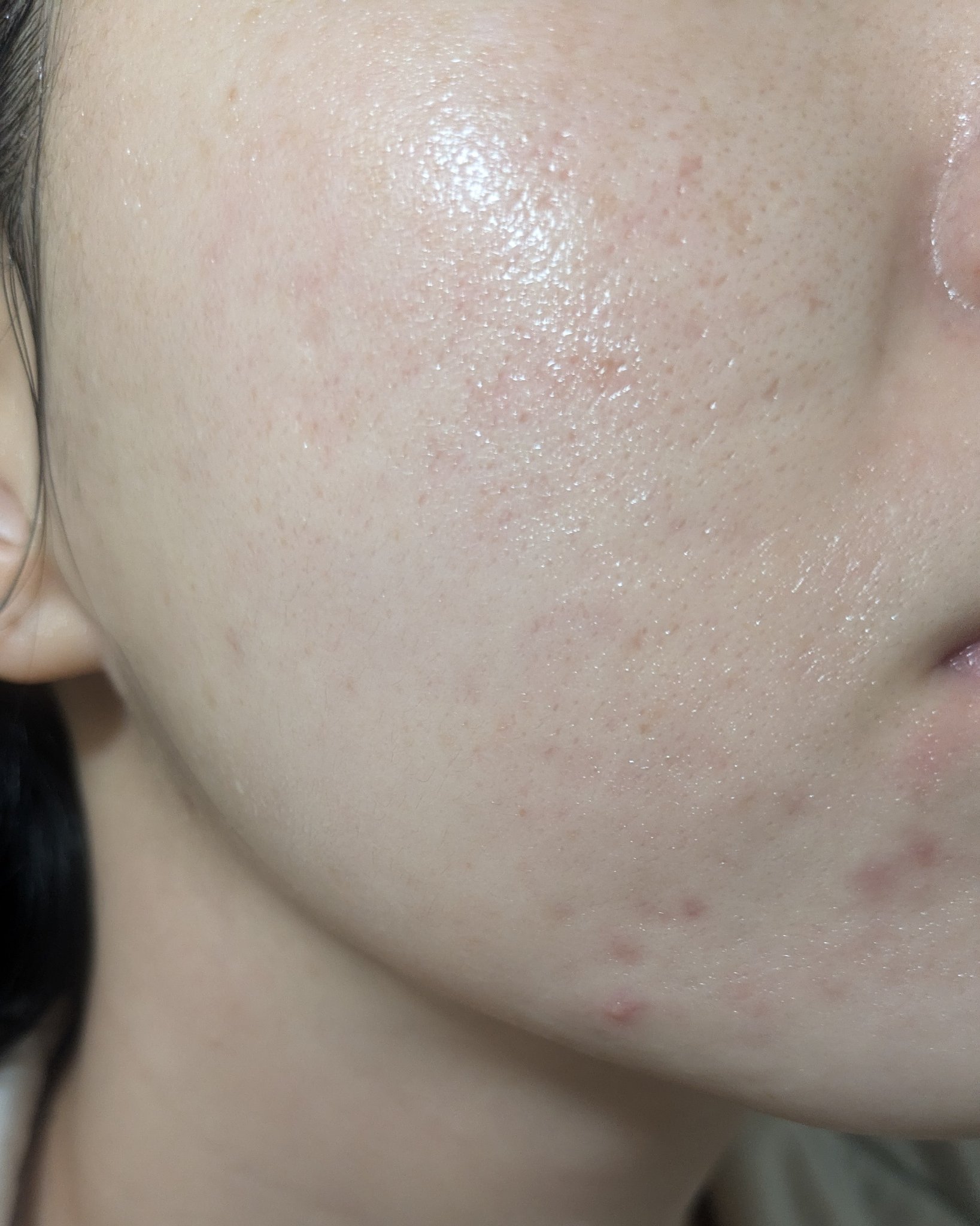 10/28の#汚肌工事録

光で落ち着いてるように見える😅