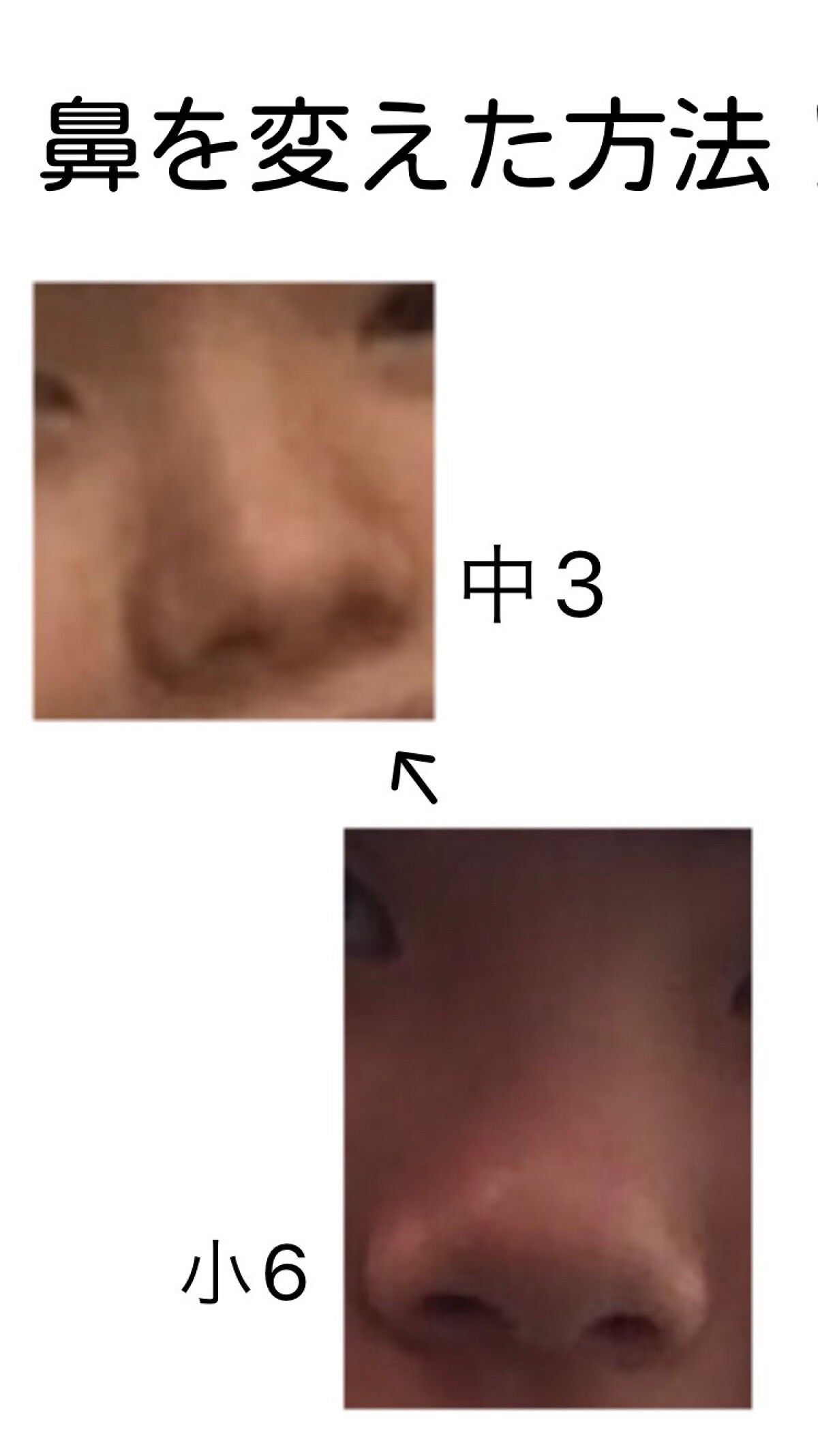 て on LIPS 「団子鼻をマシにした方法①小鼻をひたすら潰す勉強中の空いている片..」(1枚目)